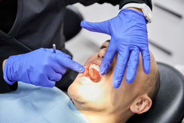 Best Emergency Dentist for Knocked-Out Tooth in Bayview, CA
